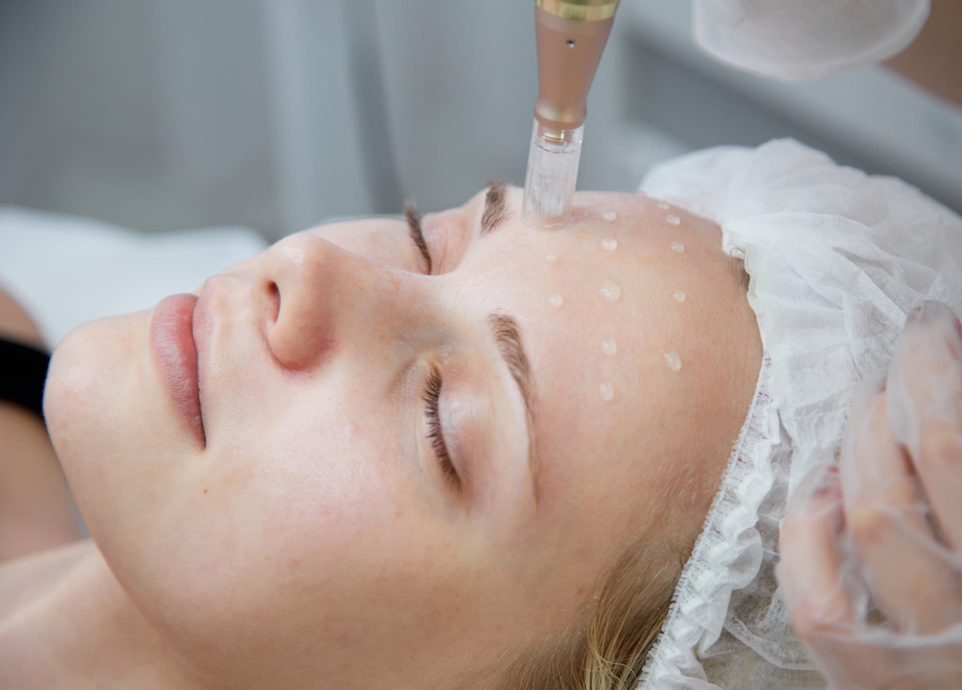 Mésothérapie à Paris : tarifs | Médecine esthétique | Dr Taveau